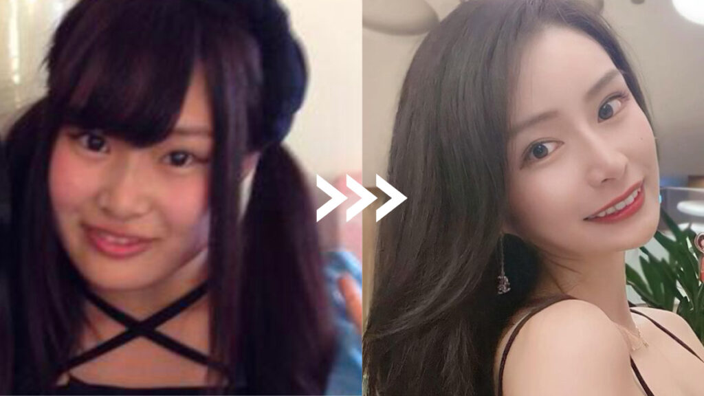 美少年のメンバー金指一世の彼女、キャバ嬢瞳の整形前と現在の顔の比較画像