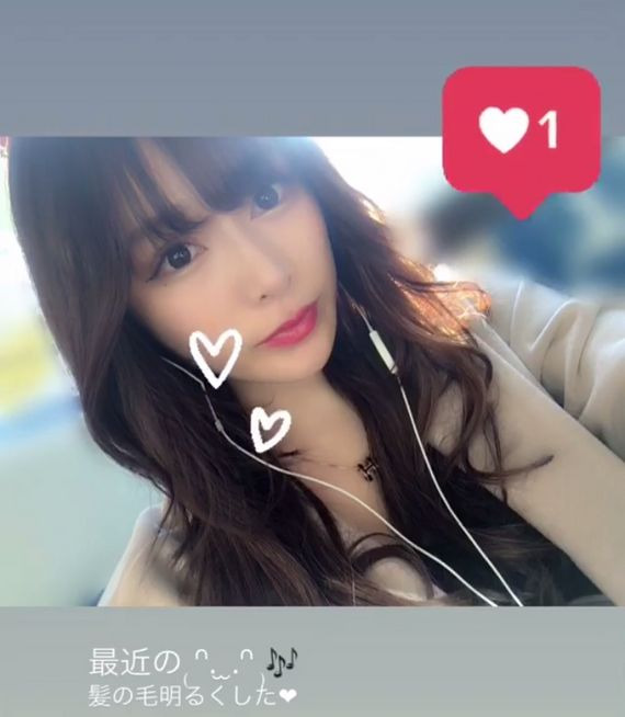 美少年のメンバー金指一世の彼女、キャバ嬢瞳の整形途中