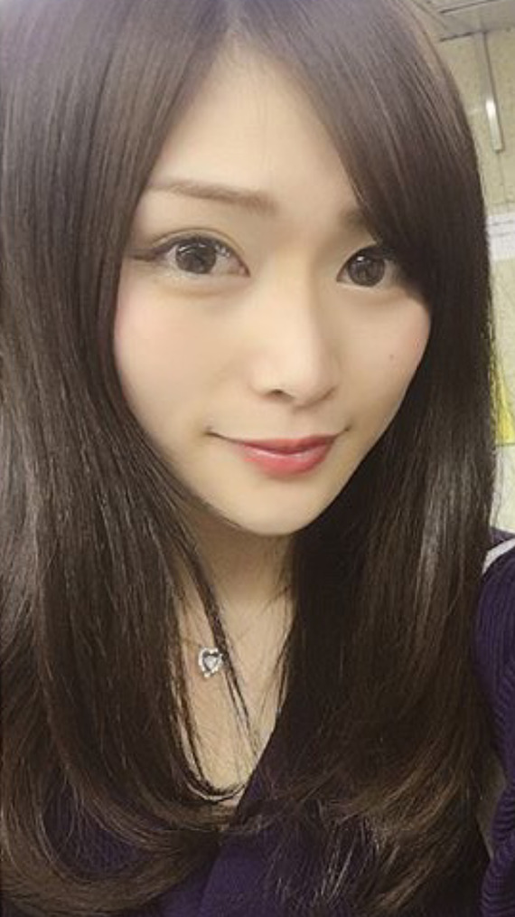 美少年のメンバー金指一世の彼女、キャバ嬢瞳の整形途中