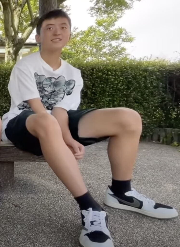 話題の中学生YouTuberちょんまげ小僧のメンバー、右足