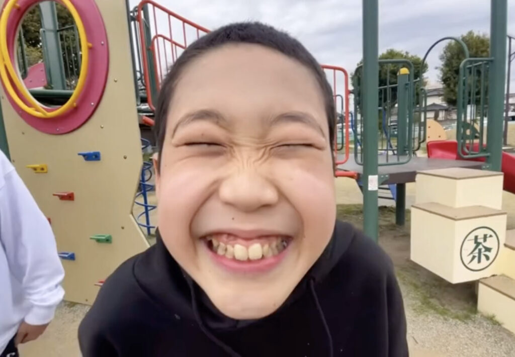 話題の中学生YouTuberちょんまげ小僧のメンバー、イソ・ギンチャクの顔