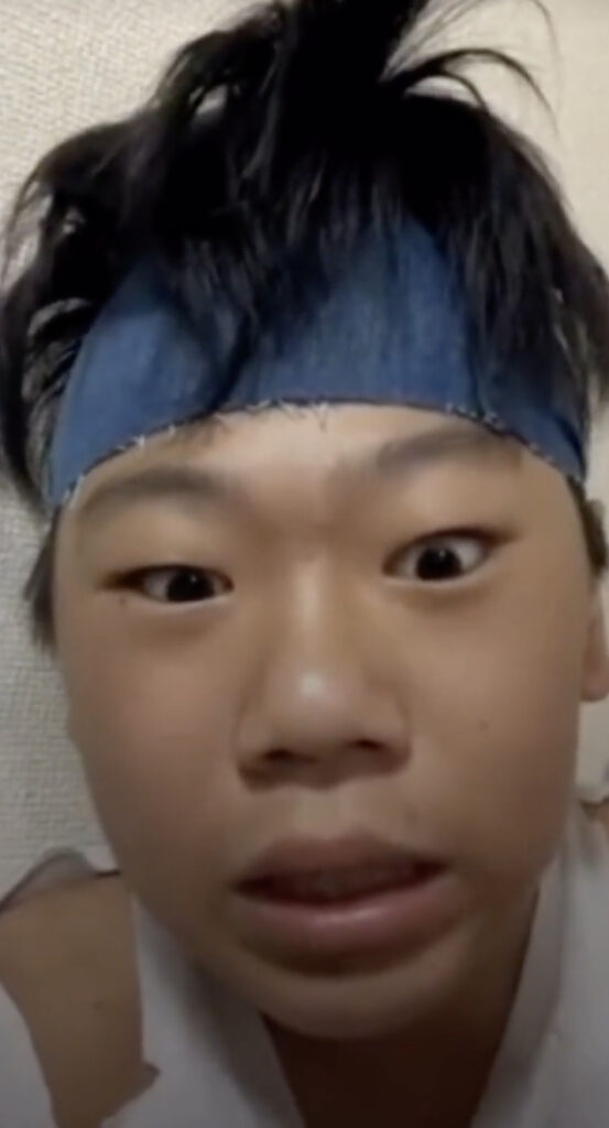 話題の中学生YouTuberちょんまげ小僧のメンバー、ナマズの顔